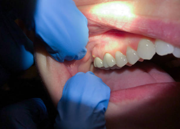 Best Cracked Tooth Emergency Dentist  in Tupelo, MS